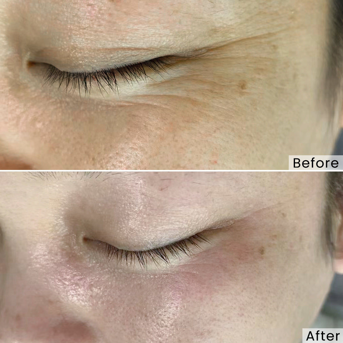 Maschera per terapia della luce LED GYH | La soluzione definitiva per ...